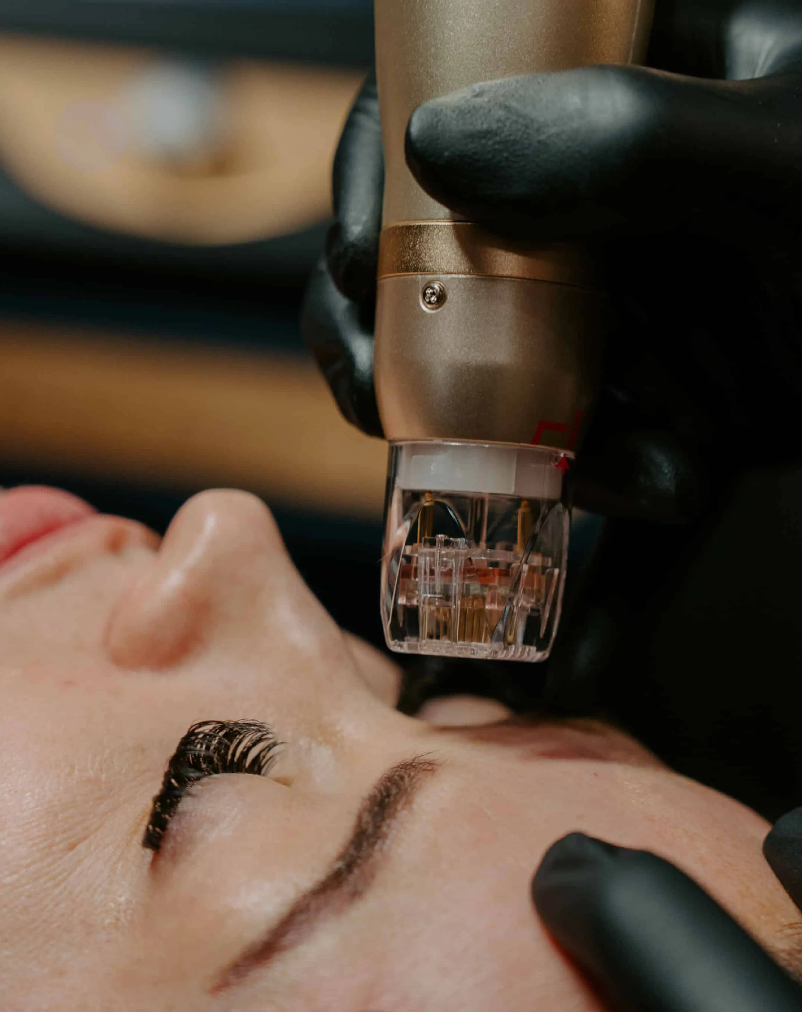 What to expect from treatment at Toronto medical spa